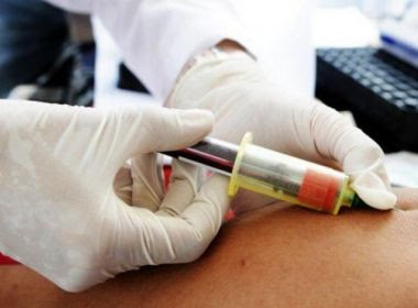 Lacen passa a realizar exame em tempo real para detectar vírus HPV