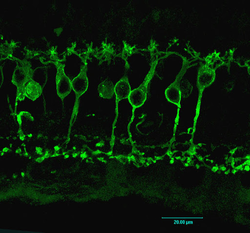 Two extensions , axion and one dendrite