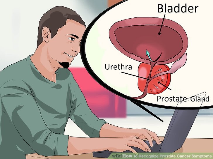 How does prostate cancer start