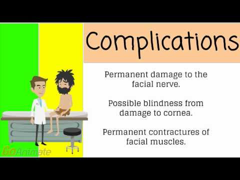 Nurse Study Net Bell s Palsy Pathophysiology Nursing Nurse Study Net Bell s Palsy Pathophysiology Nursing