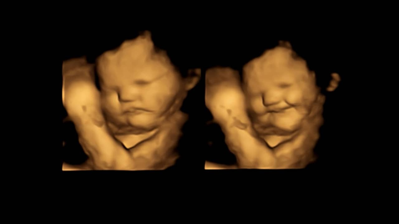 Ongeboren kinderen houden volgens studie van wortel, maar niet van boerenkool