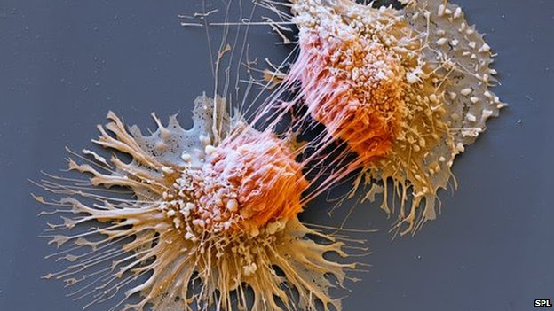 Dividing cancer cell