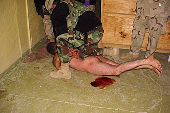 Abu Ghraib Folterszene - blutender, nackter Gefangener. Zu diesem Foto existieren verschiedene Versionen. Eine besagt, der Gefangene ist bereits tot, eine andere, er sei lediglich durch einen Hundebiss verletzt und es handele sich nicht um Folter.