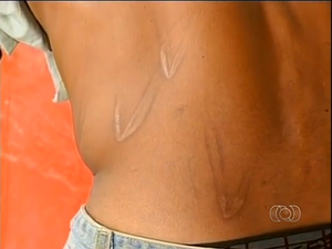 Um deles mostra marcas que ele diz ser de chibatadas (Foto: Reprodução/TV Anhanguera)