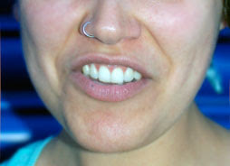 LipCurle