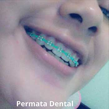 Model Behel Fashion Terbaru Contoh Soal Dan Contoh Pidato Lengkap