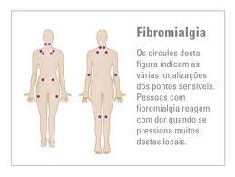 fibromialgia fibromialgia