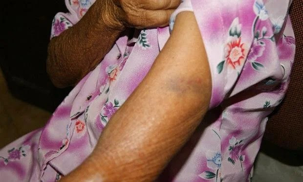 Idosa foi agredida durante assalto na zona rural, afirma polícia / Foto: Divulgação/Adielson Galvão. Idosa foi agredida durante assalto na zona rural, afirma polícia / Foto: Divulgação/Adielson Galvão.