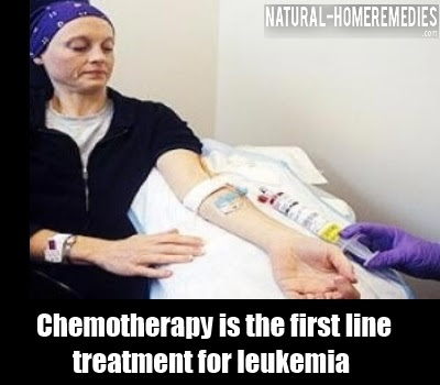 6 Best Treatments For Leukemia How To Treat Leukemia 6 Best Treatments For Leukemia How To Treat Leukemia