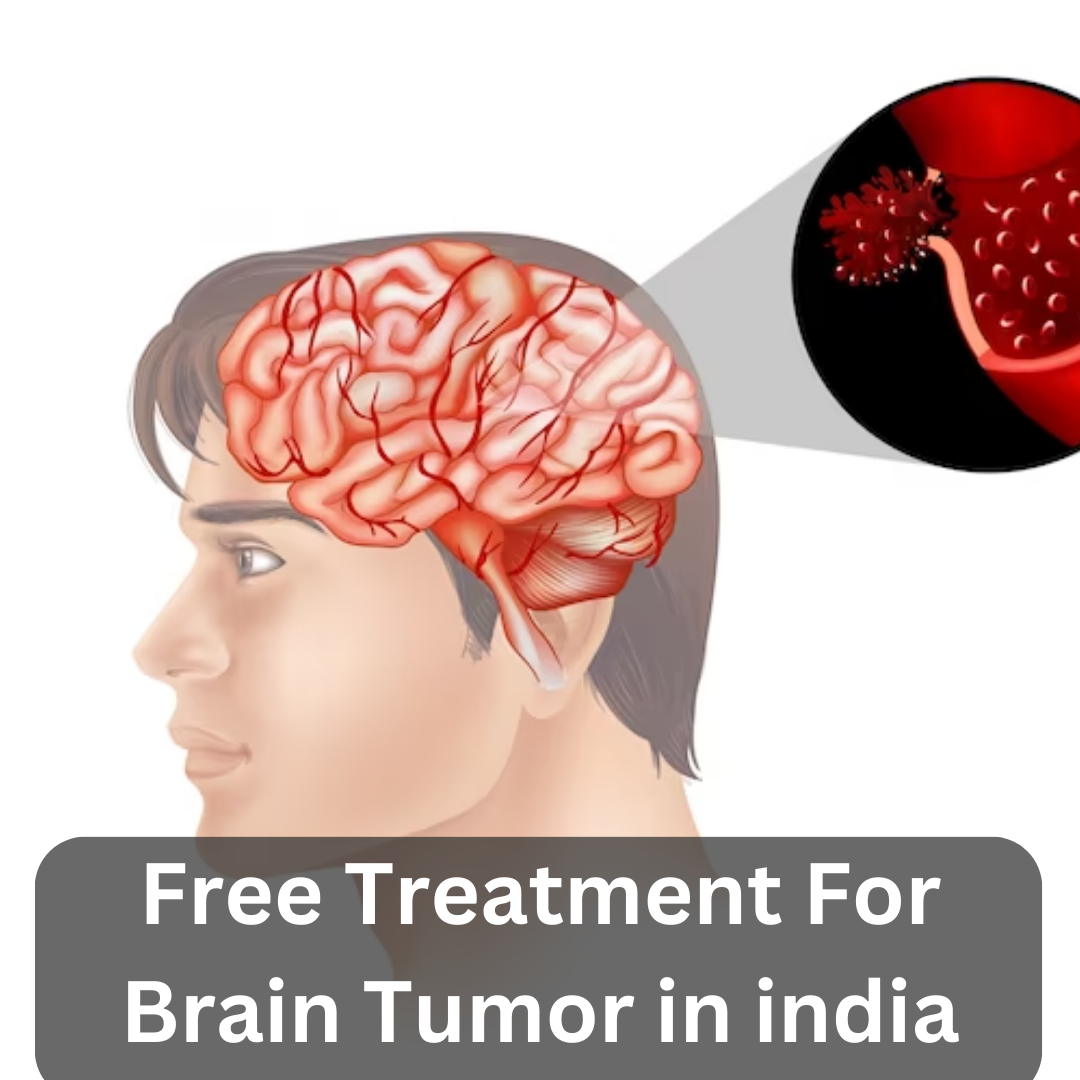 free treatment for brain tumor in India