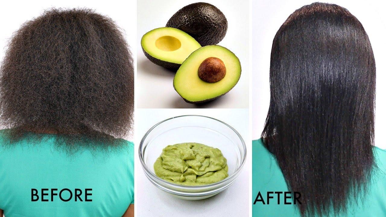 Image result for treatment bald women Avokado