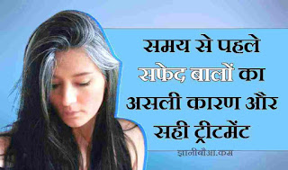 Vitamin B12 Deficiency Leads To Premature White Hair in Hindi
