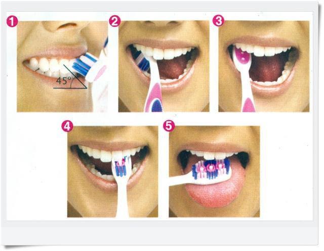 menyikat gigi yang benar: metode menyikat gigi yang benar