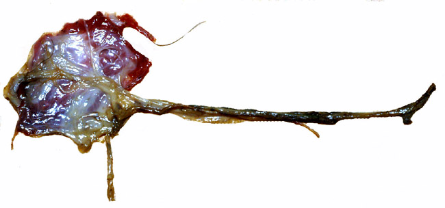 Fetal surface of fresh Aye-aye placenta