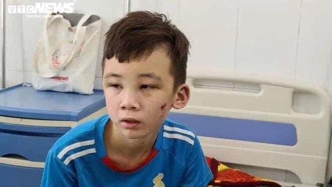 NHỮNG ĐỨA TRẺ BỊ ĐOẠ ĐÀY 