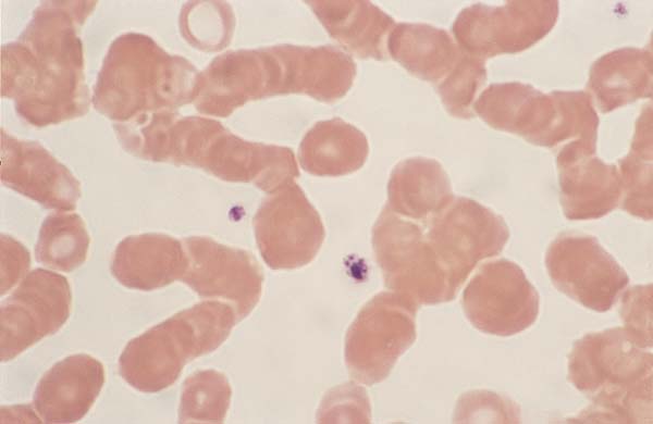 Canine blood smear. The platelet located at lower center contains Ehrlichia platys morula (100x).