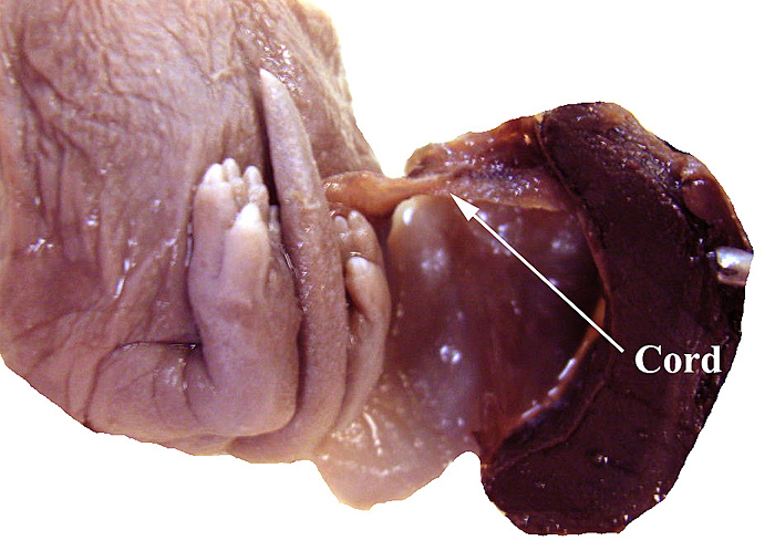 The delicate, 1 cm-long umbilical cord connects the abdomen to the placental disk.