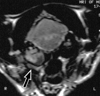 Transverse, T2-weighted image of a cat with middle ear squamous cell carcinoma