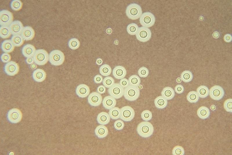 Nhiễm nấm cryptococcus: Nguyên nhân, triệu chứng, chẩn đoán và điều trị