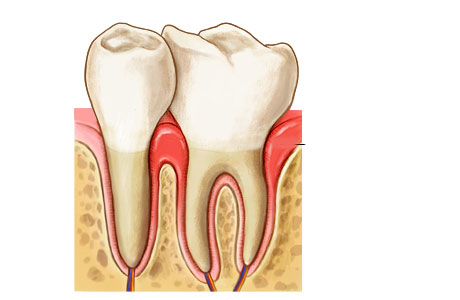 Bệnh viêm lợi là gì? Phòng và điều trị viêm lợi như thế nào? 1 Bệnh viêm lợi là gì?