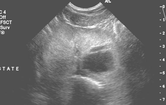 Sonogram showing the prostate of a 6-year-old male German shepherd with tenesmus, stranguria, and hematuria