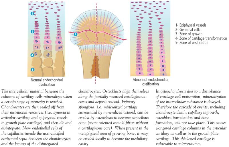 Normal and abnormal process of endochondral ossification in the growth plates and growing articular cartilage