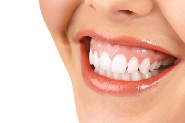 Quy trình đánh lún răng diễn ra thế nào?