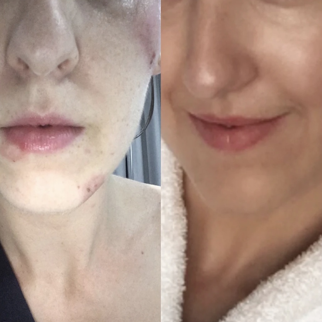 Kora Organics Review