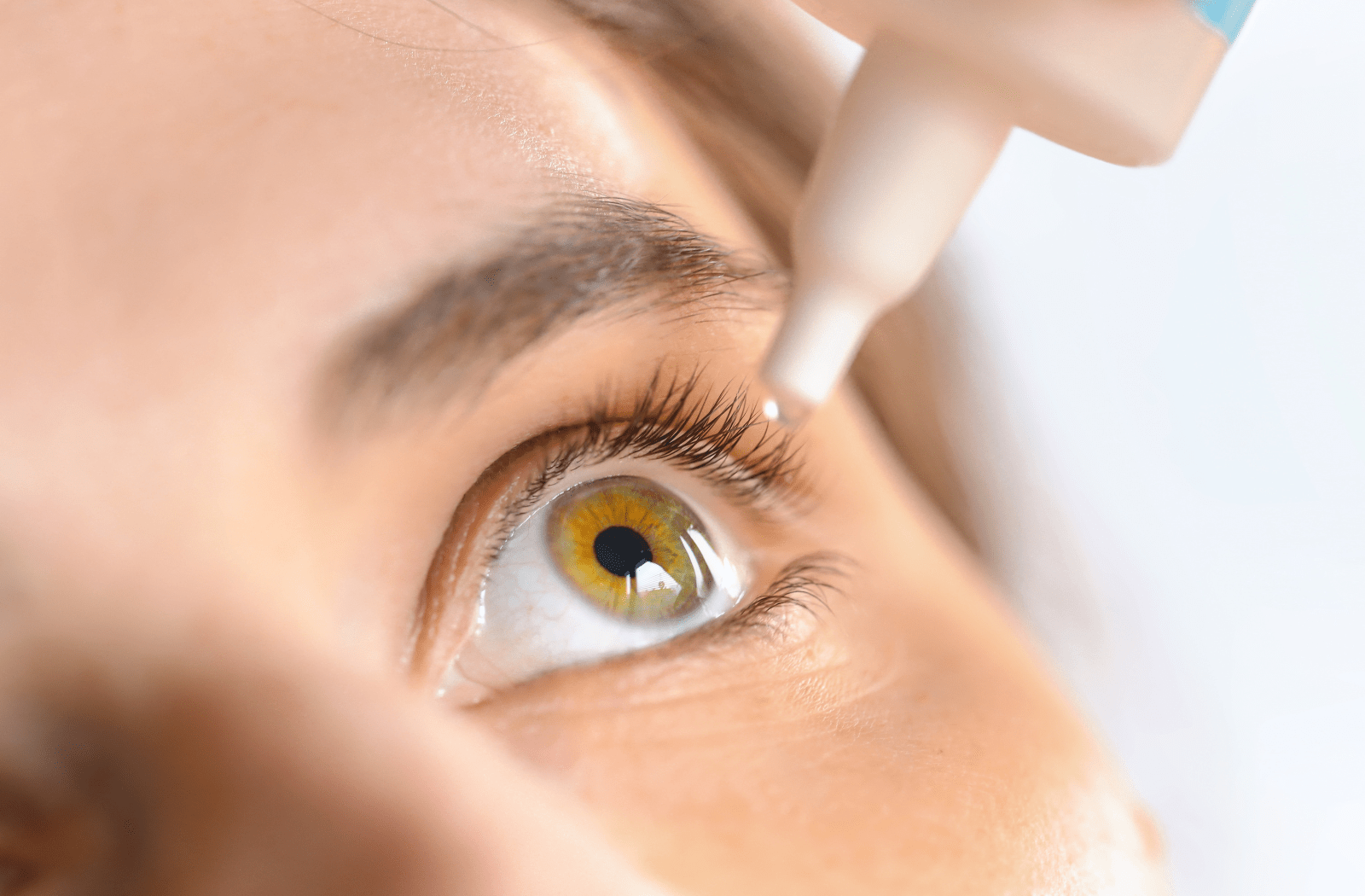 A woman putting eye drops into her eye to treat dry eye