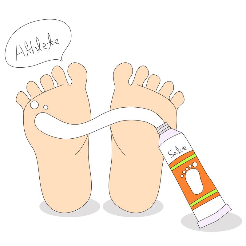 무한반복 가려움에 처치곤란 각질까지! 무좀 어떻게 없애지?