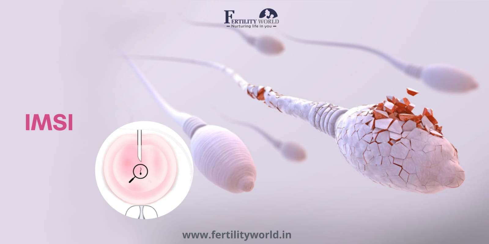 Intracytoplasmic morphologically selected sperm injection (IMSI)