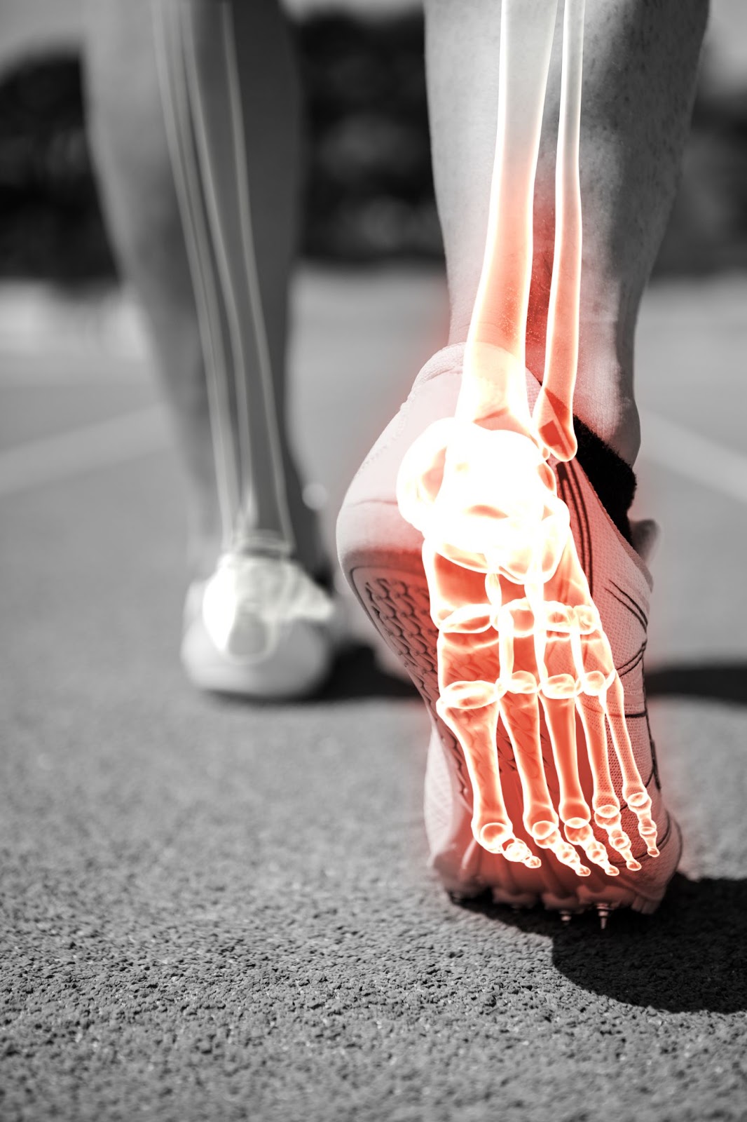 Ankle Pain (Skeletal). We Fix Feet.