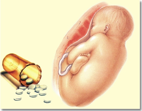 مضاعفات وأعراض ارتفاع ضغط الدم - ويب طب