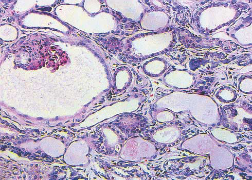 Histopathological images of renal parenchyma in a Cocker Spaniel diagnosed with familial nephropathy