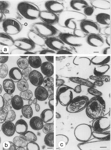 Eupyrene and Apyrene Sperm: Dichotomous Spermatogenesis in Lepidoptera -  ScienceDirect