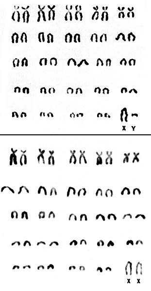 Karyotypes of Murrah buffalo, an Indian dairy breed. 2n=50.