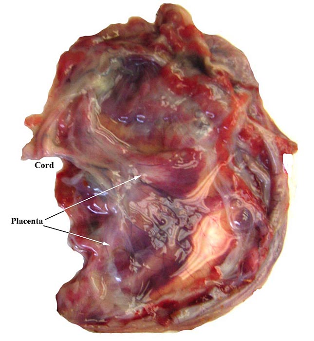 The placenta of our first case is still attached to the uterus.