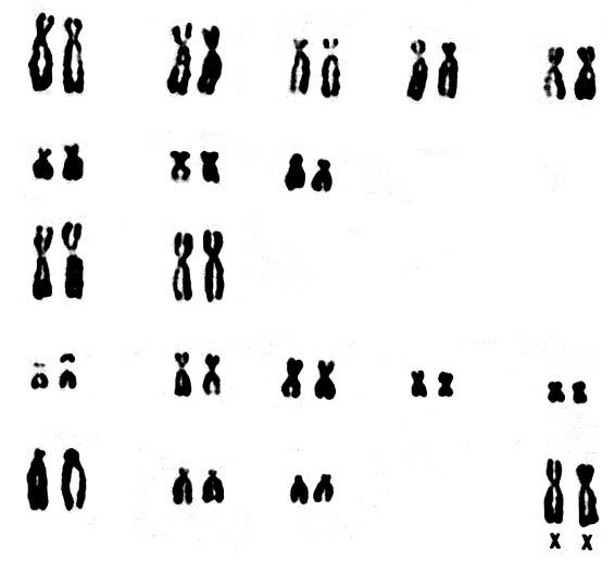 Karyotypes of Nasua narica
