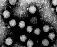 アデノウイルスの電子顕微鏡写真