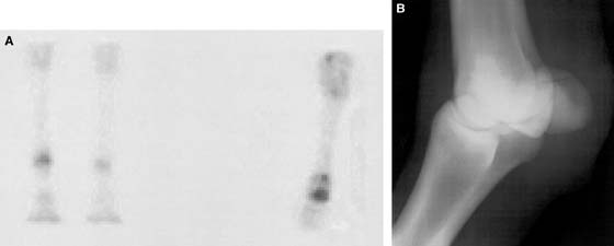 (A) Dorsal (left two images) and flexed dorsal (right image) delayed-phase scintigraphic images and (B) the dorsomedial palmarolateral oblique digital radiographic projection of the fetlock joint of a 4-yr-old STB pacer with right forelimb lameness localized to the digit by palmar digital analgesia.