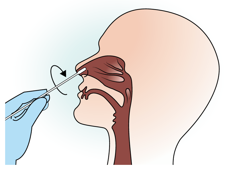 The nasal swab method