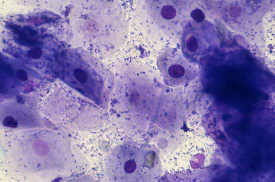 Photomicrograph of a vaginal smear collected during proestrus, showing an increased numbers of epithelial cells including small intermediate, large intermediate and superficial cells