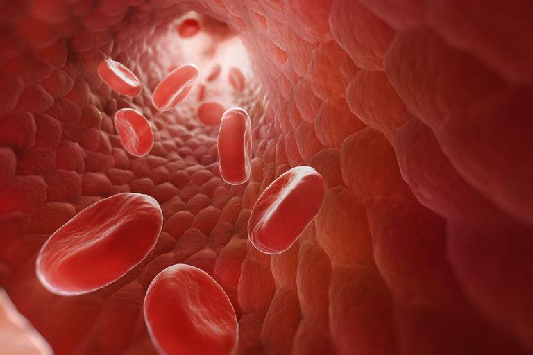 Tìm hiểu về bệnh đa hồng cầu nguyên phát | Vinmec