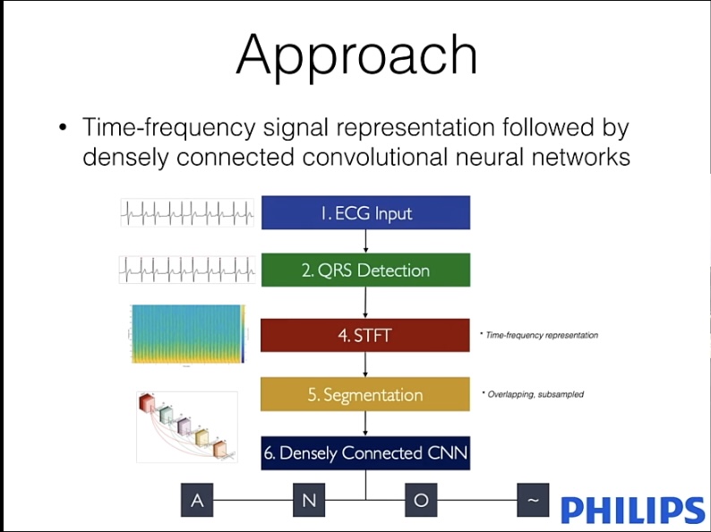 Time-frequency signal representation followed by densely connected convolutional neural networks