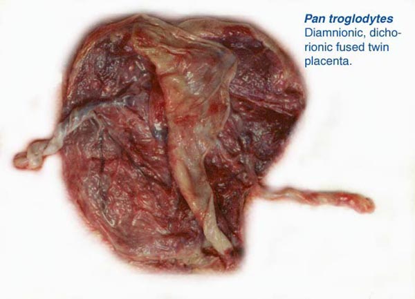 Twin placenta of common chimpanzee, a fused, diamnionic, dichorionic organ