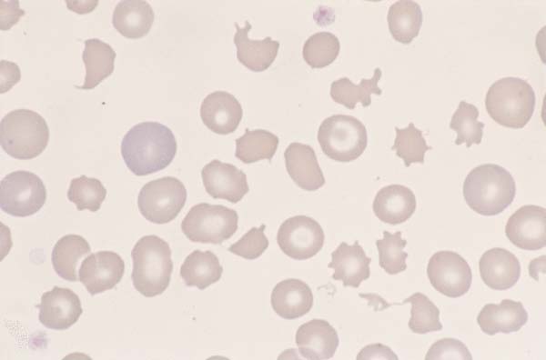 Canine blood. Marked anisocytosis and poikilocytosis are present...