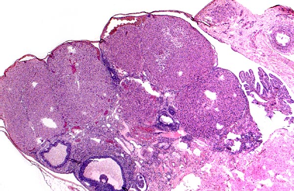Ovary with several corpora lutea and a few Graafian follicles. Fallopian tube at right.