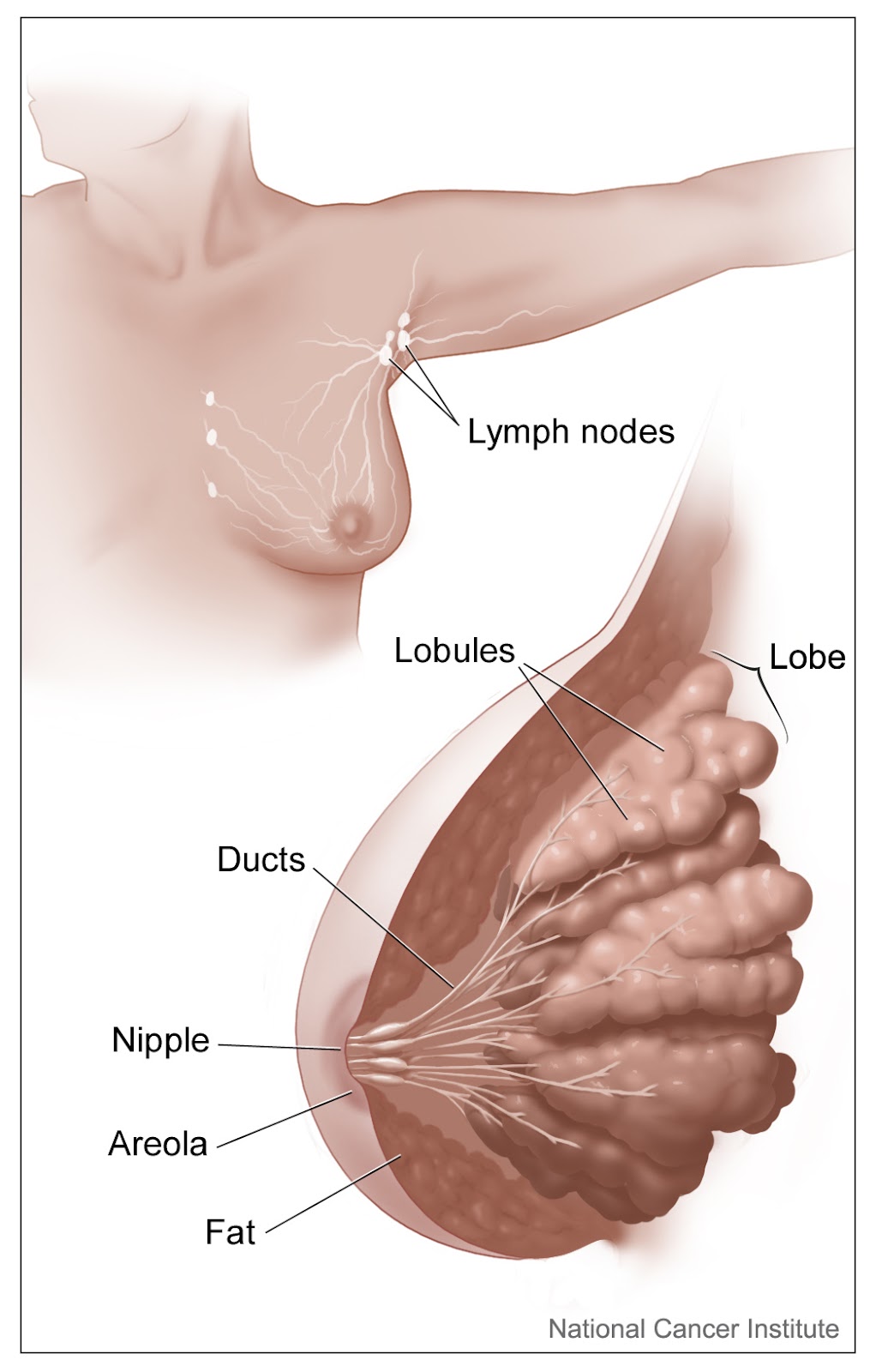 A diagram of the parts of a breast: lobules, lobe, ducts, nipple, areola, fat, and lymph nodes.