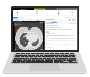 Virtual Nodule Clinic on laptop CT
