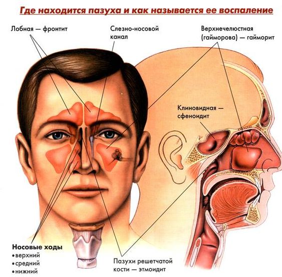 Челюстно-лицевая хирургия занимается лечением гайморита и других воспалительных заболеваний в области лица